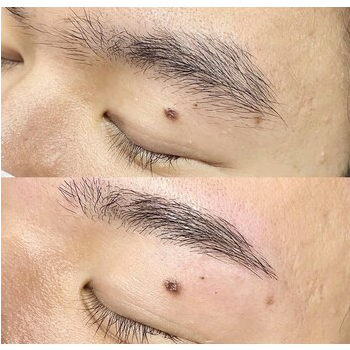 メンズアイブロウで清潔感をアップ！千葉店のご案内の眉毛デザイン写真