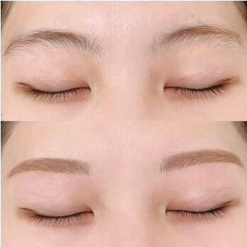 美眉に変身！仙台での間引き施術体験の眉毛デザイン写真