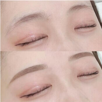 ナチュラルな美眉を手に入れる間引き施術の眉毛デザイン写真
